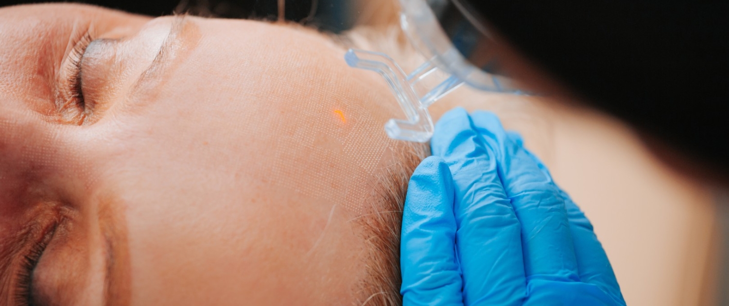 Detalle tratamiento laser co2 clinica mitre